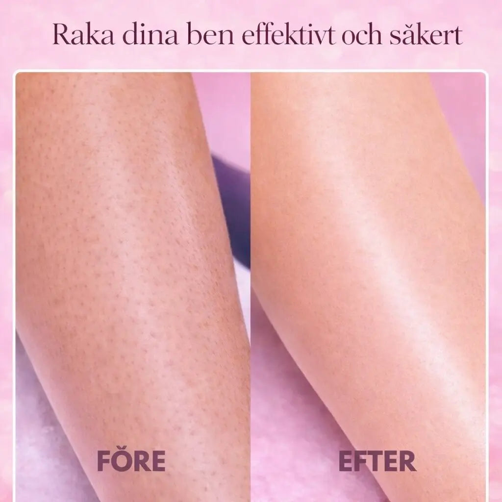 SilkVera intimtrimmer